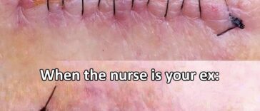 When your nurse is your ex