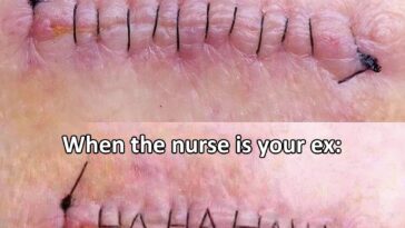 When your nurse is your ex