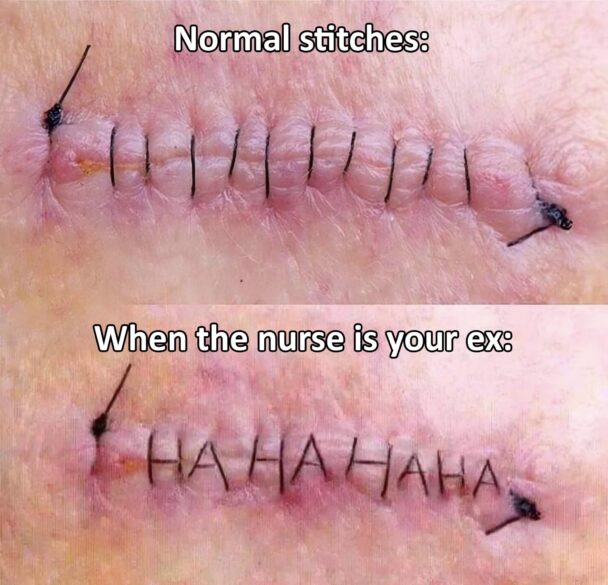 When your nurse is your ex